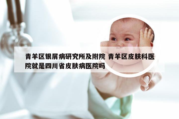 青羊区银屑病研究所及附院 青羊区皮肤科医院就是四川省皮肤病医院吗
