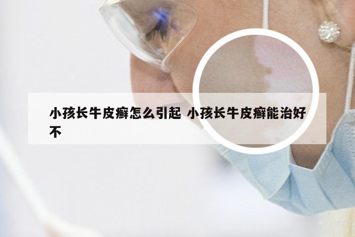 小孩长牛皮癣怎么引起 小孩长牛皮癣能治好不
