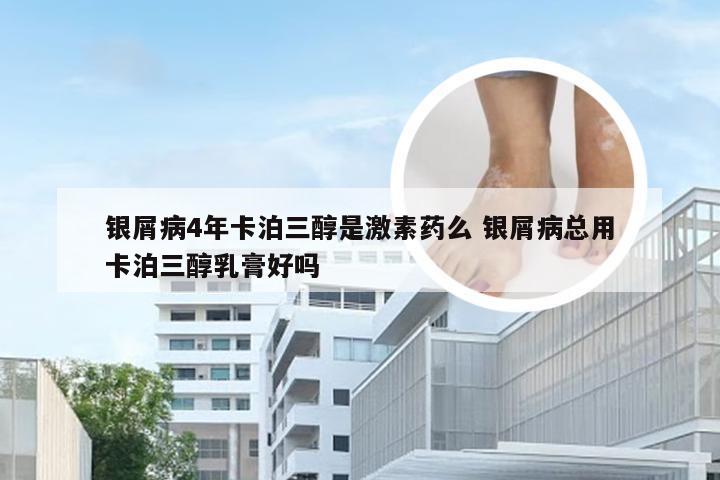 银屑病4年卡泊三醇是激素药么 银屑病总用卡泊三醇乳膏好吗