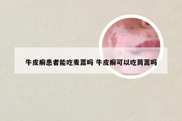 牛皮癣患者能吃麦蒿吗 牛皮癣可以吃茼蒿吗