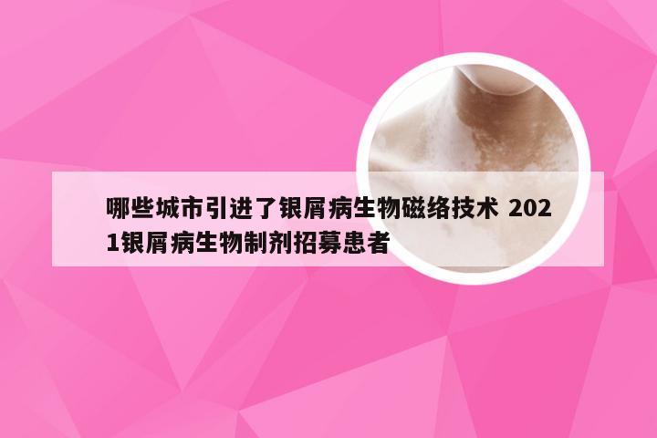 哪些城市引进了银屑病生物磁络技术 2021银屑病生物制剂招募患者