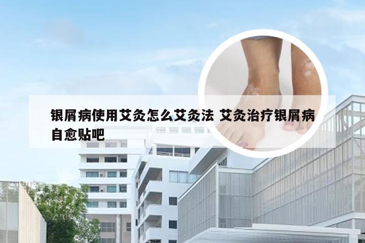 银屑病使用艾灸怎么艾灸法 艾灸治疗银屑病自愈贴吧