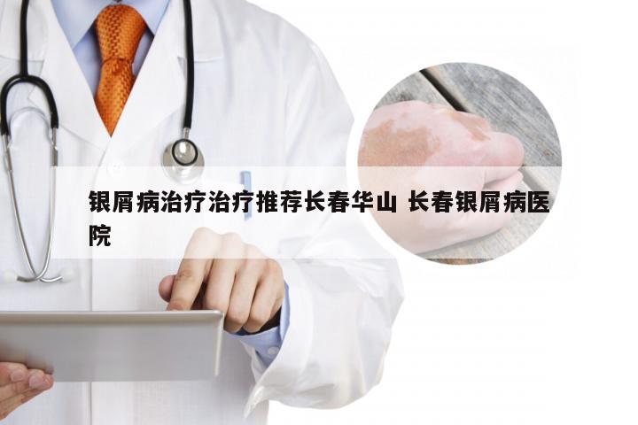 银屑病治疗治疗推荐长春华山 长春银屑病医院