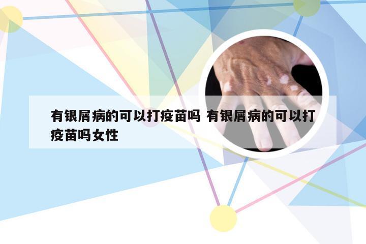 有银屑病的可以打疫苗吗 有银屑病的可以打疫苗吗女性