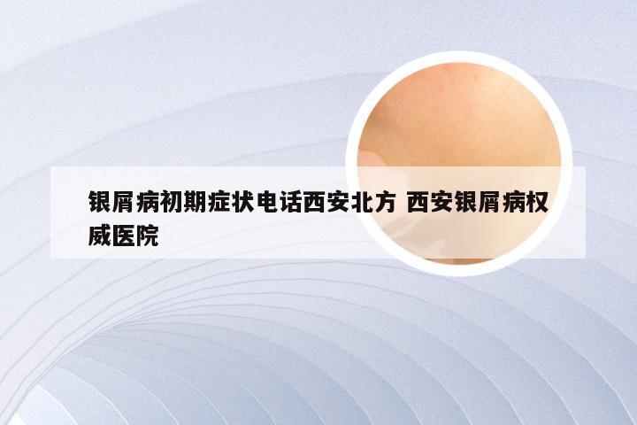 银屑病初期症状电话西安北方 西安银屑病权威医院