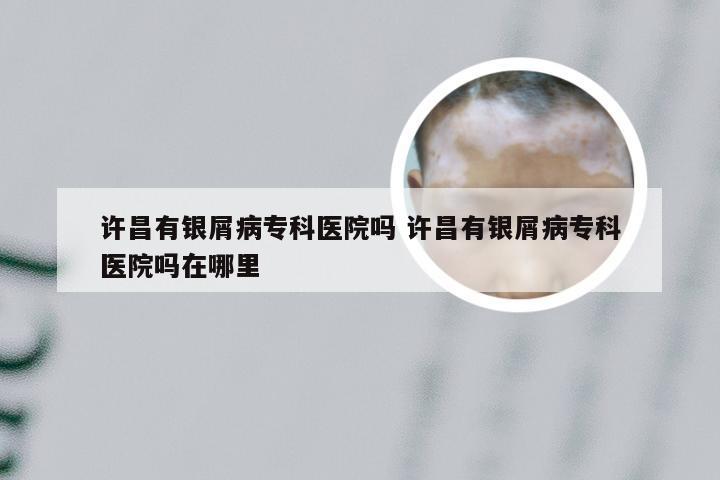 许昌有银屑病专科医院吗 许昌有银屑病专科医院吗在哪里