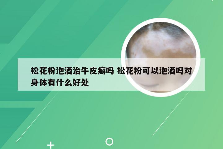 松花粉泡酒治牛皮癣吗 松花粉可以泡酒吗对身体有什么好处