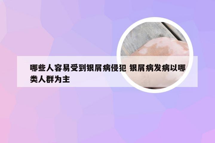 哪些人容易受到银屑病侵犯 银屑病发病以哪类人群为主