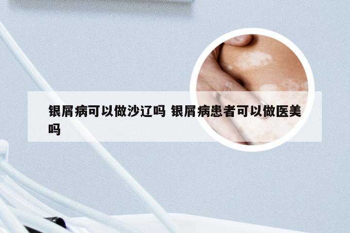 银屑病可以做沙辽吗 银屑病患者可以做医美吗