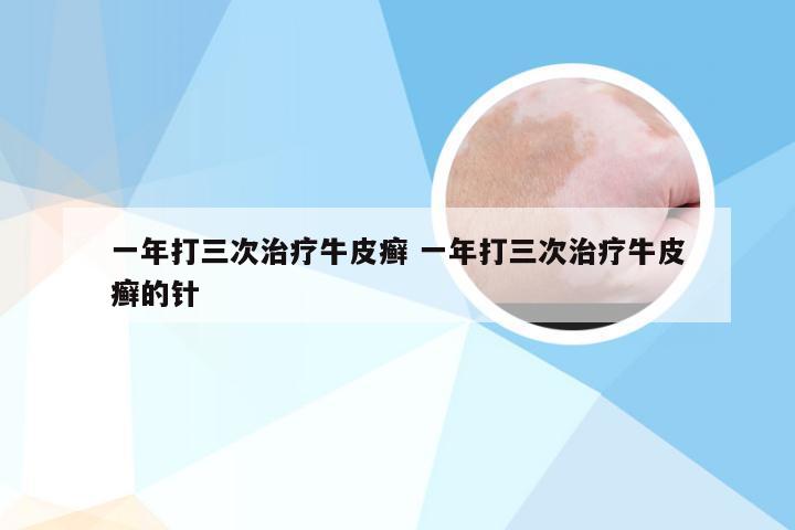 一年打三次治疗牛皮癣 一年打三次治疗牛皮癣的针