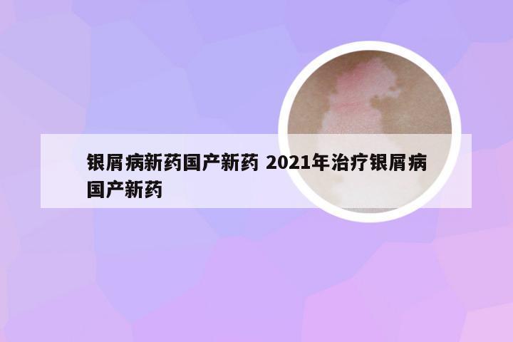 银屑病新药国产新药 2021年治疗银屑病国产新药
