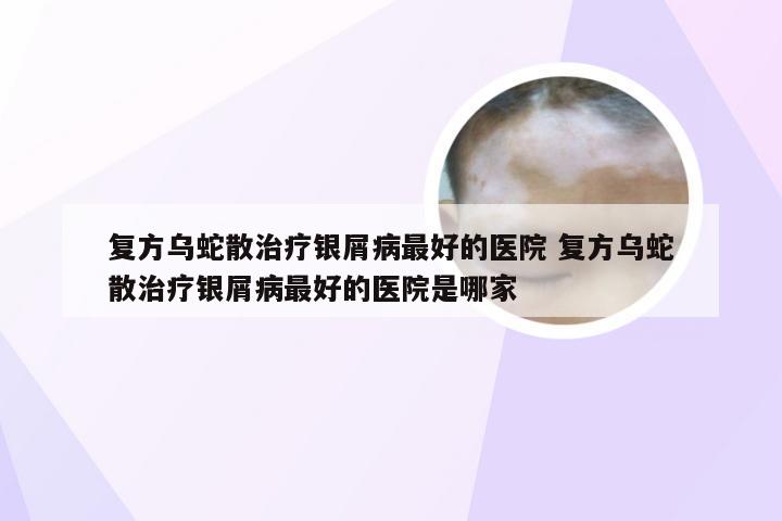 复方乌蛇散治疗银屑病最好的医院 复方乌蛇散治疗银屑病最好的医院是哪家