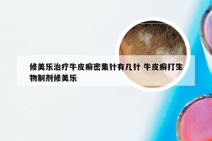 修美乐治疗牛皮癣密集针有几针 牛皮癣打生物制剂修美乐