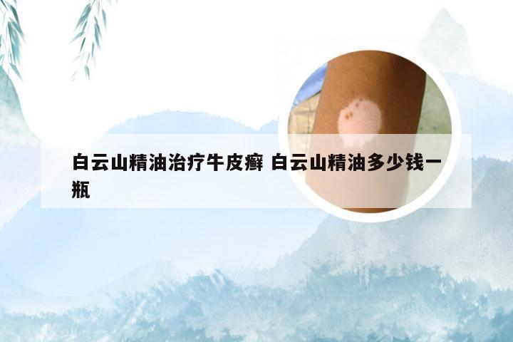 白云山精油治疗牛皮癣 白云山精油多少钱一瓶