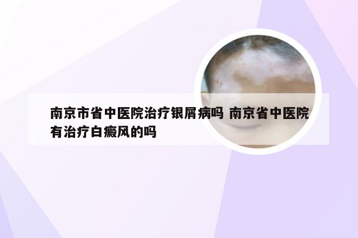 南京市省中医院治疗银屑病吗 南京省中医院有治疗白癜风的吗