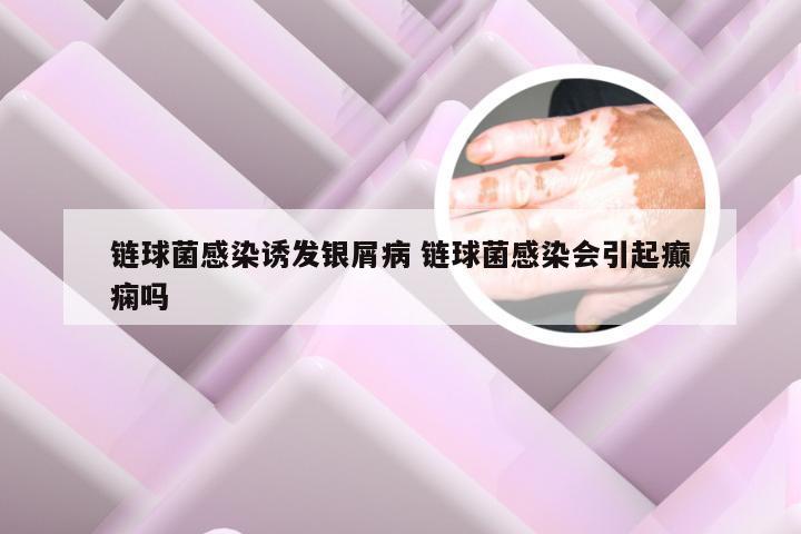 链球菌感染诱发银屑病 链球菌感染会引起癫痫吗