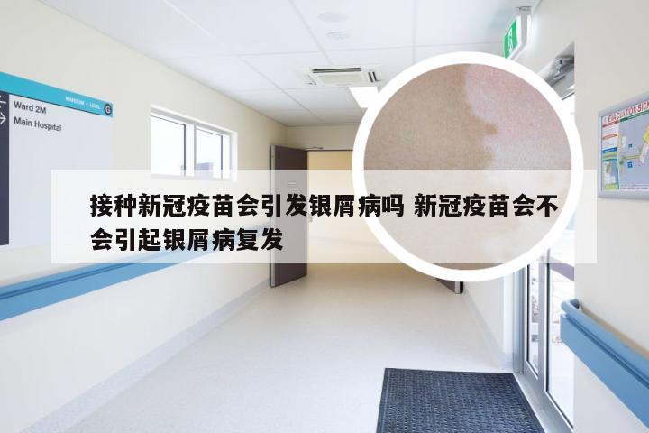 接种新冠疫苗会引发银屑病吗 新冠疫苗会不会引起银屑病复发