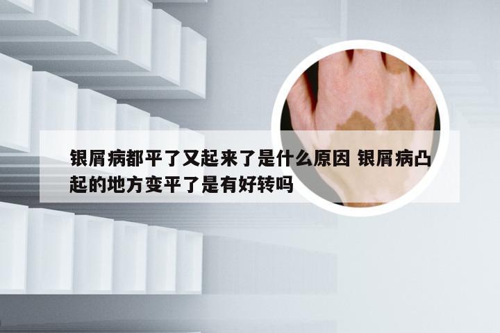 银屑病都平了又起来了是什么原因 银屑病凸起的地方变平了是有好转吗