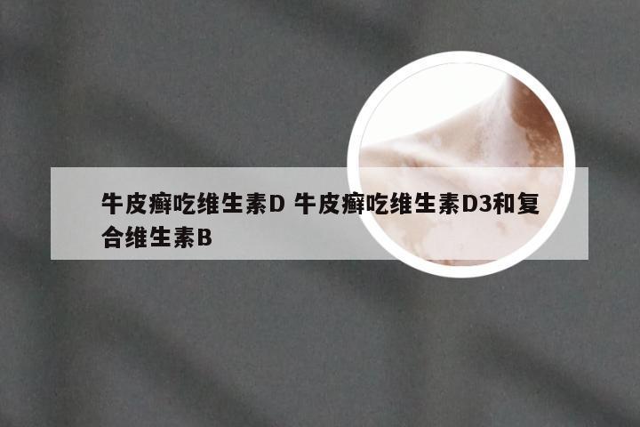 牛皮癣吃维生素D 牛皮癣吃维生素D3和复合维生素B