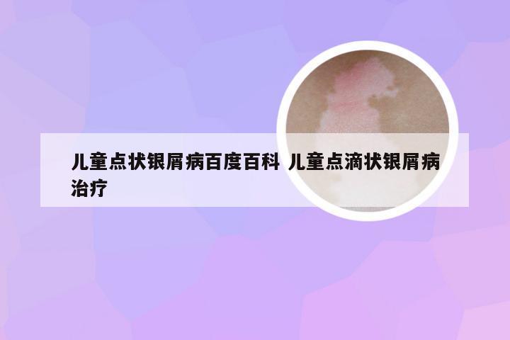 儿童点状银屑病百度百科 儿童点滴状银屑病治疗