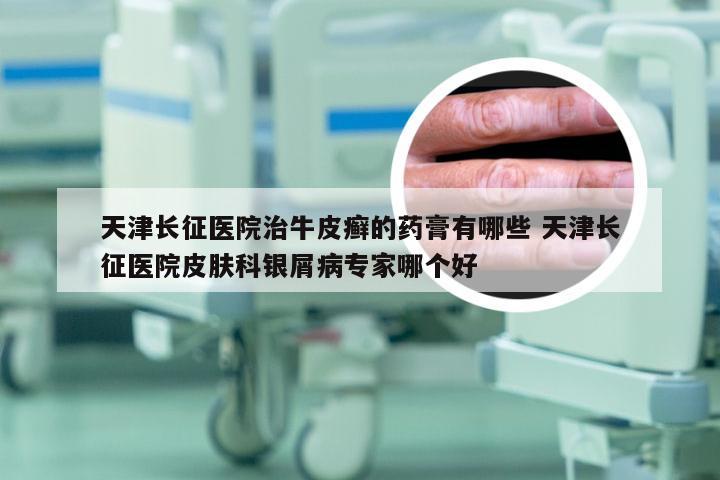 天津长征医院治牛皮癣的药膏有哪些 天津长征医院皮肤科银屑病专家哪个好