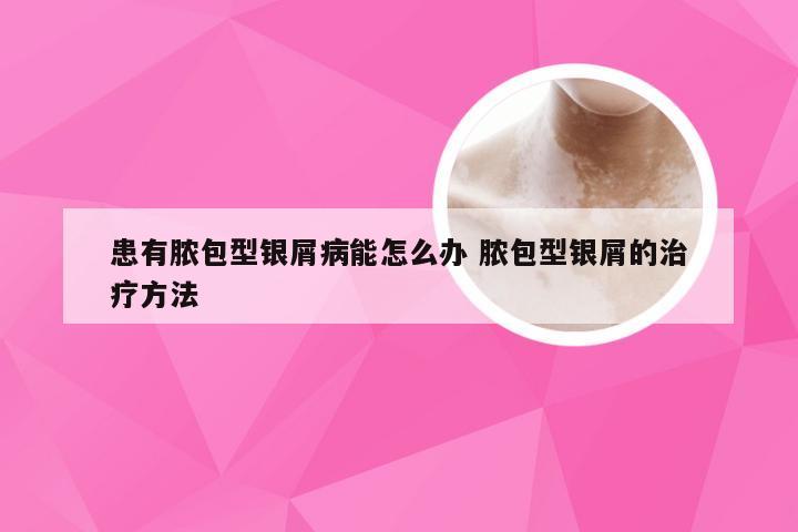 患有脓包型银屑病能怎么办 脓包型银屑的治疗方法