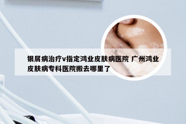 银屑病治疗v指定鸿业皮肤病医院 广州鸿业皮肤病专科医院搬去哪里了