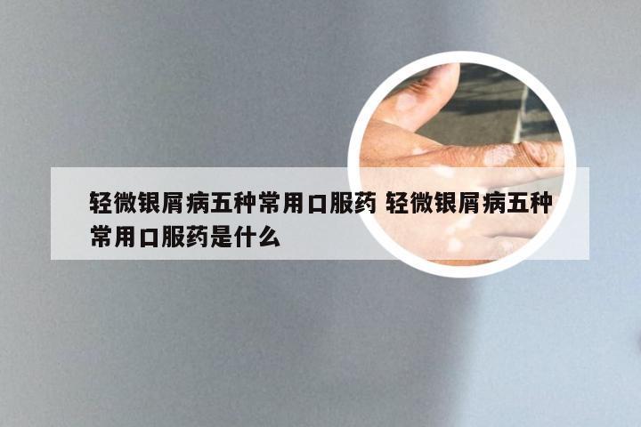轻微银屑病五种常用口服药 轻微银屑病五种常用口服药是什么