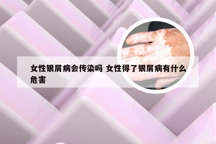 女性银屑病会传染吗 女性得了银屑病有什么危害