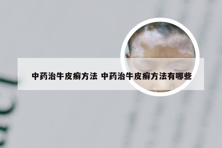 中药治牛皮癣方法 中药治牛皮癣方法有哪些